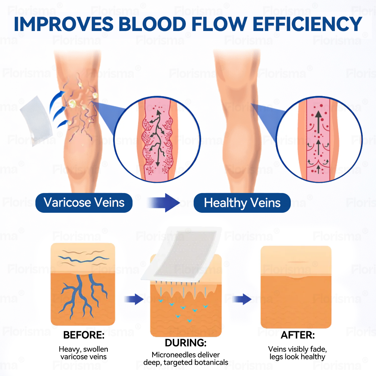 Un parche al día. Alivio visible de las venas en solo 7 días 👨‍⚕️ 𝑭𝑳𝑶𝑹𝑰𝑺𝑴𝑨® 𝐃𝐢𝐨𝐬𝐦𝐢𝐧𝐚 𝐲 𝐇𝐞𝐬𝐩𝐞𝐫𝐢𝐝𝐢𝐧𝐚: 𝐏𝐚𝐫𝐜𝐡𝐞 𝐝𝐞 𝐌𝐢𝐜𝐫𝐨𝐧𝐞𝐞𝐝𝐥𝐞𝐬 𝐜𝐨𝐧 𝐅ó𝐫𝐦𝐮𝐥𝐚 𝐝𝐞 𝐆𝐫𝐚𝐝𝐨 𝐂𝐥í𝐧𝐢𝐜𝐨🔔
