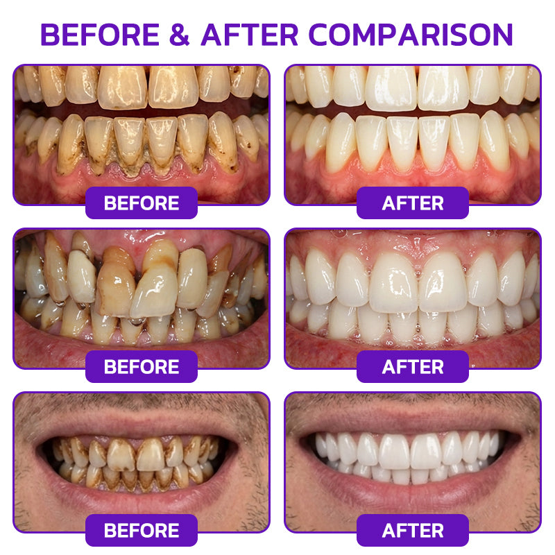 Rolimey® VioCore Bee Venom Gingivitis & Periodontitis Treatment Toothpaste 🥝