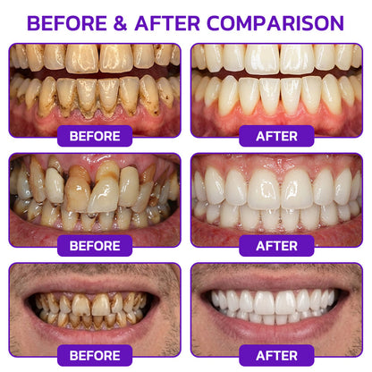 Rolimey® VioCore Bee Venom Gingivitis & Periodontitis Treatment Toothpaste 🥝