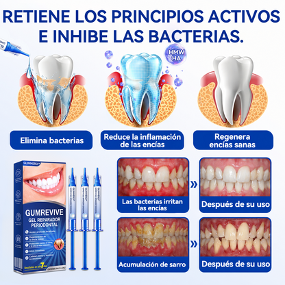 🦷🌼𝑮𝒍𝒊𝒎𝒎𝒆𝒓𝒍𝒚® 𝑮𝒖𝒎𝑹𝒆𝒗𝒊𝒗𝒆 𝑮𝒆𝒍 𝑹𝒆𝒑𝒂𝒓𝒂𝒅𝒐𝒓 𝑷𝒆𝒓𝒊𝒐𝒅𝒐𝒏𝒕𝒂𝒍
