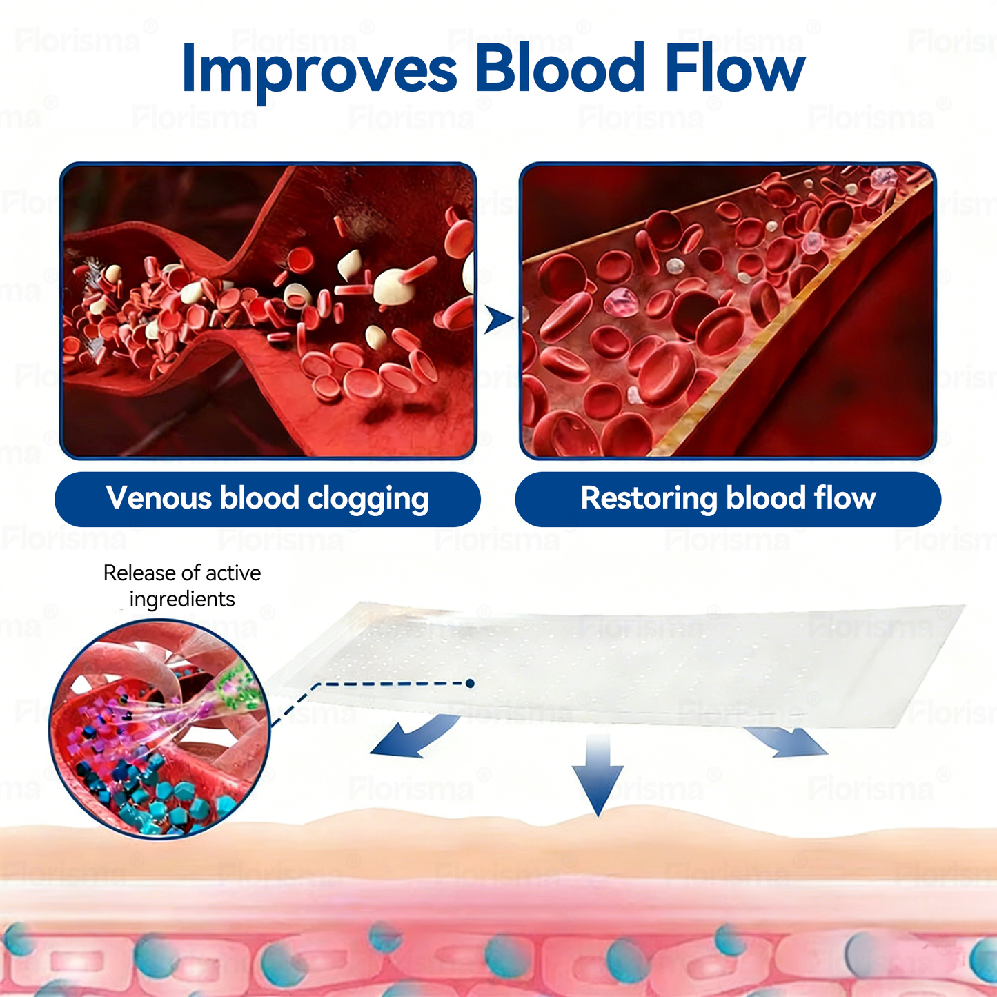Un parche al día. Alivio visible de las venas en solo 7 días 👨‍⚕️ 𝑭𝑳𝑶𝑹𝑰𝑺𝑴𝑨® 𝐃𝐢𝐨𝐬𝐦𝐢𝐧𝐚 𝐲 𝐇𝐞𝐬𝐩𝐞𝐫𝐢𝐝𝐢𝐧𝐚: 𝐏𝐚𝐫𝐜𝐡𝐞 𝐝𝐞 𝐌𝐢𝐜𝐫𝐨𝐧𝐞𝐞𝐝𝐥𝐞𝐬 𝐜𝐨𝐧 𝐅ó𝐫𝐦𝐮𝐥𝐚 𝐝𝐞 𝐆𝐫𝐚𝐝𝐨 𝐂𝐥í𝐧𝐢𝐜𝐨🔔