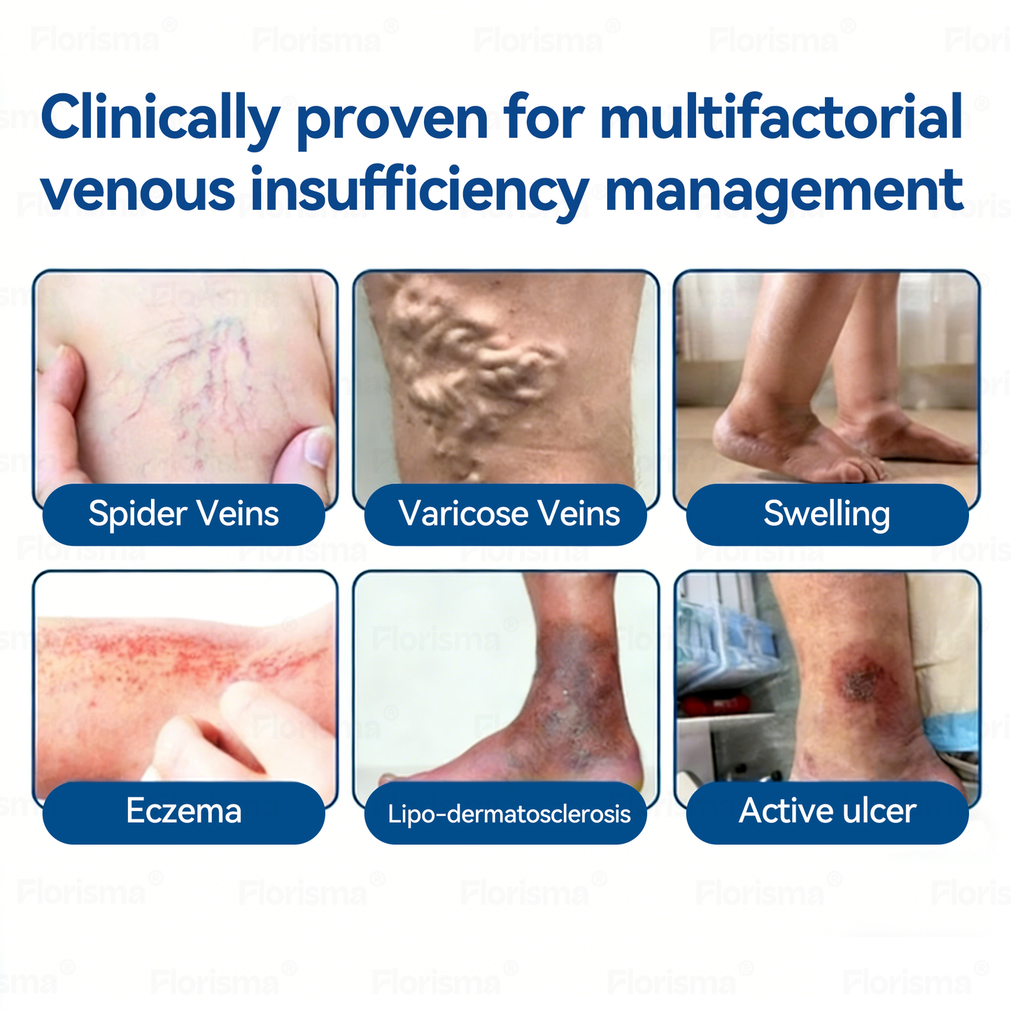 Un parche al día. Alivio visible de las venas en solo 7 días 👨‍⚕️ 𝑭𝑳𝑶𝑹𝑰𝑺𝑴𝑨® 𝐃𝐢𝐨𝐬𝐦𝐢𝐧𝐚 𝐲 𝐇𝐞𝐬𝐩𝐞𝐫𝐢𝐝𝐢𝐧𝐚: 𝐏𝐚𝐫𝐜𝐡𝐞 𝐝𝐞 𝐌𝐢𝐜𝐫𝐨𝐧𝐞𝐞𝐝𝐥𝐞𝐬 𝐜𝐨𝐧 𝐅ó𝐫𝐦𝐮𝐥𝐚 𝐝𝐞 𝐆𝐫𝐚𝐝𝐨 𝐂𝐥í𝐧𝐢𝐜𝐨🔔
