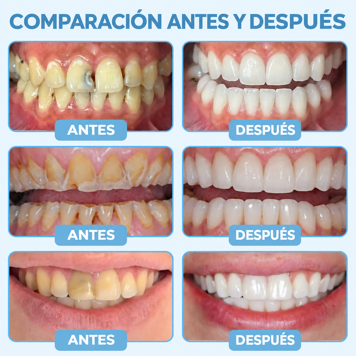 🦷🎊𝑮𝒍𝒊𝒎𝒎𝒆𝒓𝒍𝒚® 𝑮𝒖𝒎𝑹𝒆𝒗𝒊𝒗𝒆 𝑮𝒆𝒍 𝑹𝒆𝒑𝒂𝒓𝒂𝒅𝒐𝒓 𝑷𝒆𝒓𝒊𝒐𝒅𝒐𝒏𝒕𝒂𝒍