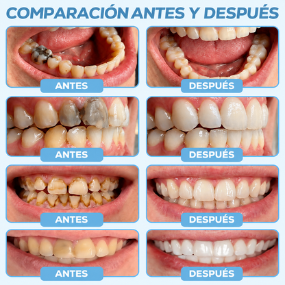🦷🎊𝑮𝒍𝒊𝒎𝒎𝒆𝒓𝒍𝒚® 𝑮𝒖𝒎𝑹𝒆𝒗𝒊𝒗𝒆 𝑮𝒆𝒍 𝑹𝒆𝒑𝒂𝒓𝒂𝒅𝒐𝒓 𝑷𝒆𝒓𝒊𝒐𝒅𝒐𝒏𝒕𝒂𝒍