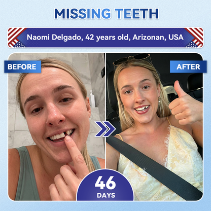 🌷𝐆𝐥𝐢𝐦𝐦𝐞𝐫𝐥𝐲® 🦷 Parche de microagujas con Tideglusib para la reparación de dientes y encías  3.0