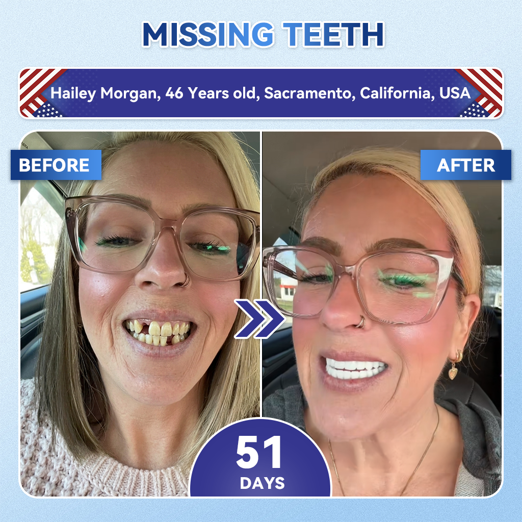 🌷𝐆𝐥𝐢𝐦𝐦𝐞𝐫𝐥𝐲® 🦷 Parche de microagujas con Tideglusib para la reparación de dientes y encías  3.0