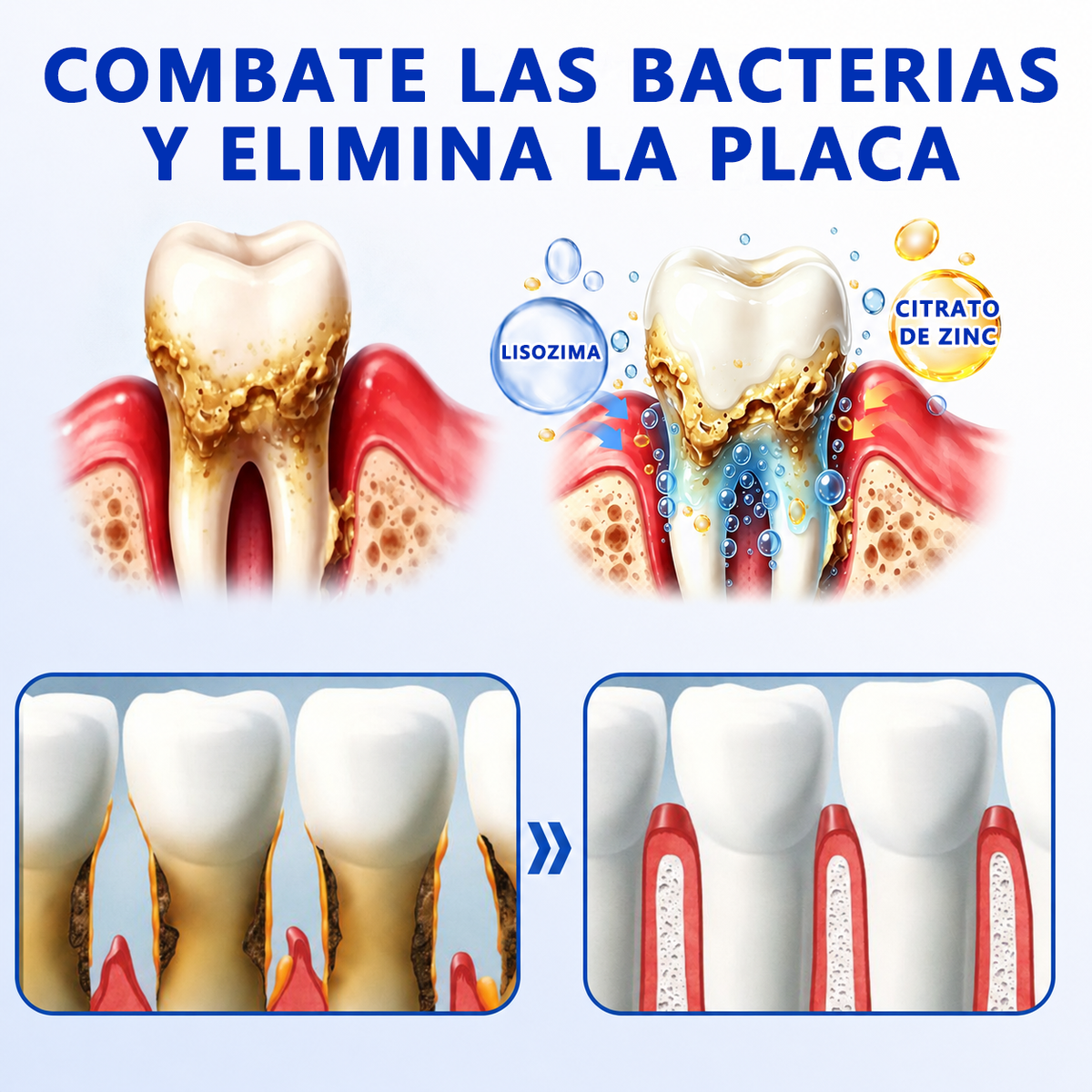 🦷🌼𝑮𝒍𝒊𝒎𝒎𝒆𝒓𝒍𝒚® 𝑮𝒖𝒎𝑹𝒆𝒗𝒊𝒗𝒆 𝑮𝒆𝒍 𝑹𝒆𝒑𝒂𝒓𝒂𝒅𝒐𝒓 𝑷𝒆𝒓𝒊𝒐𝒅𝒐𝒏𝒕𝒂𝒍
