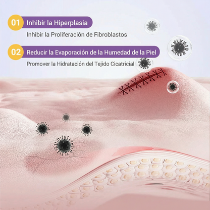 ✅Tienda oficial | BBOJI® ácido hialurónico cinta de reparación de nano micromujas 🏥(tratamiento de cicatrices antiguas y recientes, reducción de cicatrices quirúrgicas, estrías, queloides, acné, quemaduras, verrugas, dermatomas y varices)