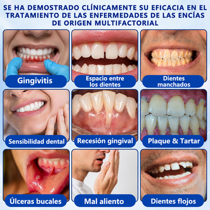 🦷🌼𝑮𝒍𝒊𝒎𝒎𝒆𝒓𝒍𝒚® 𝑮𝒖𝒎𝑹𝒆𝒗𝒊𝒗𝒆 𝑮𝒆𝒍 𝑹𝒆𝒑𝒂𝒓𝒂𝒅𝒐𝒓 𝑷𝒆𝒓𝒊𝒐𝒅𝒐𝒏𝒕𝒂𝒍