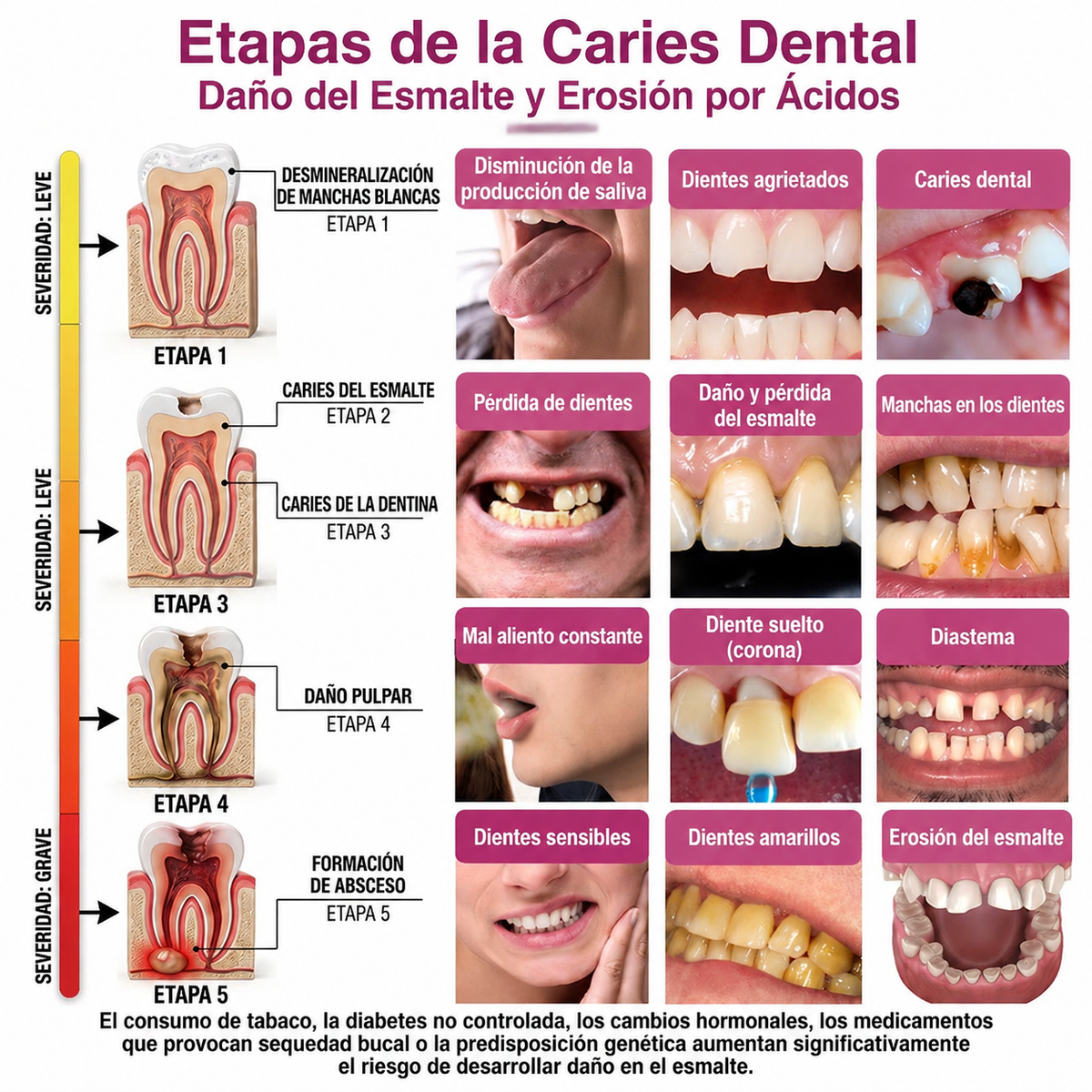🌿🍧Rolimey® DenPerm – Gel natural de relleno y reparación del esmalte dental para la restauración de caries