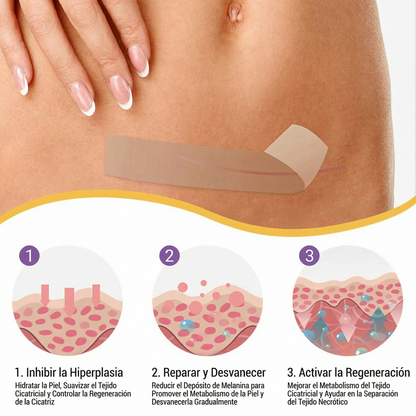 ✅Tienda oficial | BBOJI® ácido hialurónico cinta de reparación de nano micromujas 🏥(tratamiento de cicatrices antiguas y recientes, reducción de cicatrices quirúrgicas, estrías, queloides, acné, quemaduras, verrugas, dermatomas y varices)