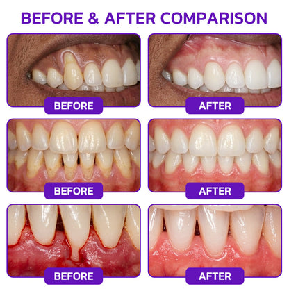 Rolimey® VioCore Bee Venom Gingivitis & Periodontitis Treatment Toothpaste 🥝