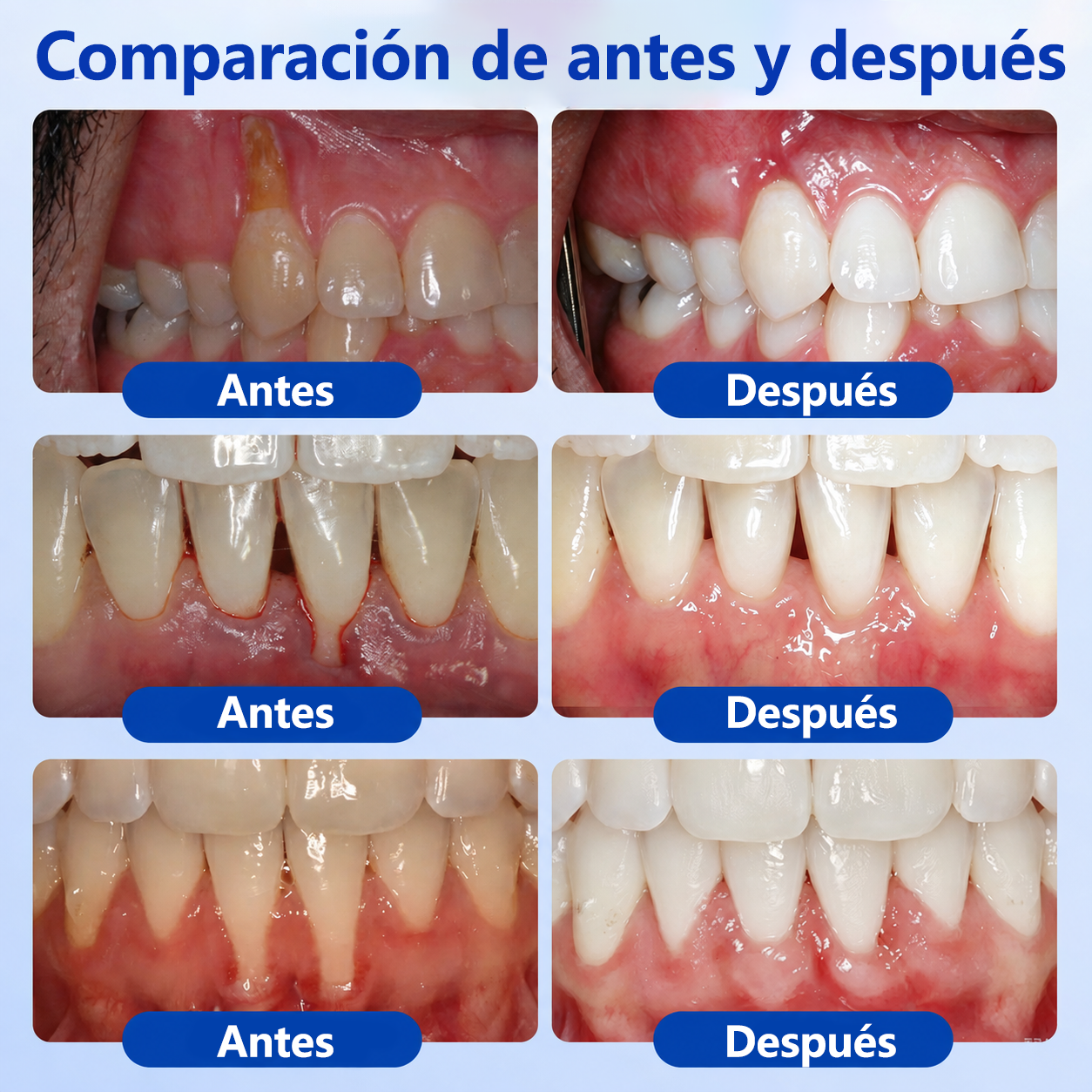 🦷🌼𝑮𝒍𝒊𝒎𝒎𝒆𝒓𝒍𝒚® 𝑮𝒖𝒎𝑹𝒆𝒗𝒊𝒗𝒆 𝑮𝒆𝒍 𝑹𝒆𝒑𝒂𝒓𝒂𝒅𝒐𝒓 𝑷𝒆𝒓𝒊𝒐𝒅𝒐𝒏𝒕𝒂𝒍