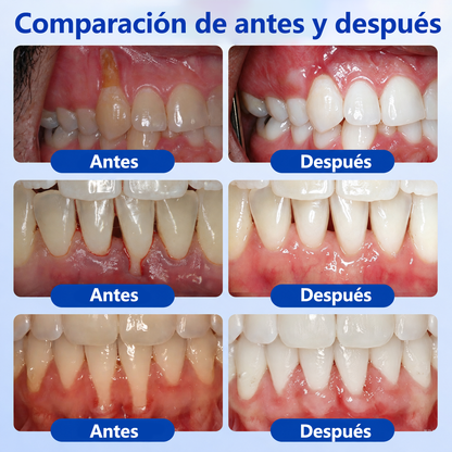 🦷🌼𝑮𝒍𝒊𝒎𝒎𝒆𝒓𝒍𝒚® 𝑮𝒖𝒎𝑹𝒆𝒗𝒊𝒗𝒆 𝑮𝒆𝒍 𝑹𝒆𝒑𝒂𝒓𝒂𝒅𝒐𝒓 𝑷𝒆𝒓𝒊𝒐𝒅𝒐𝒏𝒕𝒂𝒍