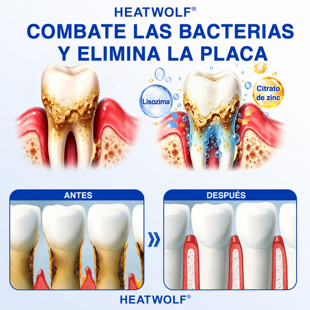 🦷3️⃣ HEATWOLF® GumRevive Gel Reparador Periodontal 💝