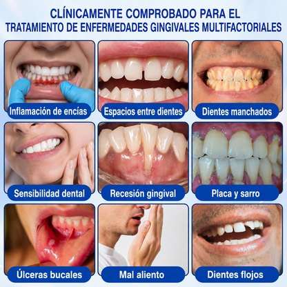 🦷3️⃣ HEATWOLF® GumRevive Gel Reparador Periodontal 💝