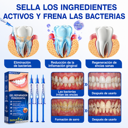 🦷3️⃣ HEATWOLF® GumRevive Gel Reparador Periodontal 💝