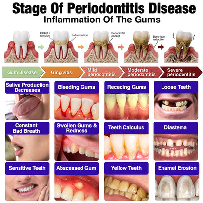 Rolimey® VioCore Bee Venom Gingivitis & Periodontitis Treatment Toothpaste 🥝